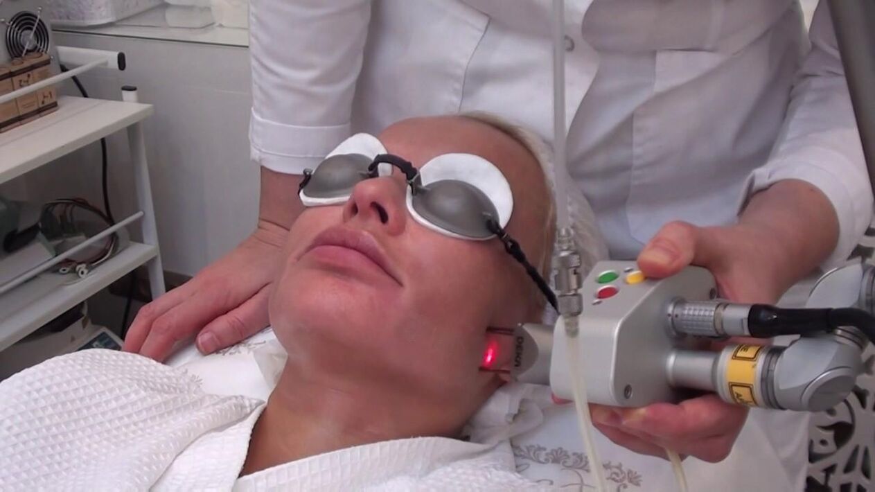 Treatment with a laser beam on problem areas of the facial skin