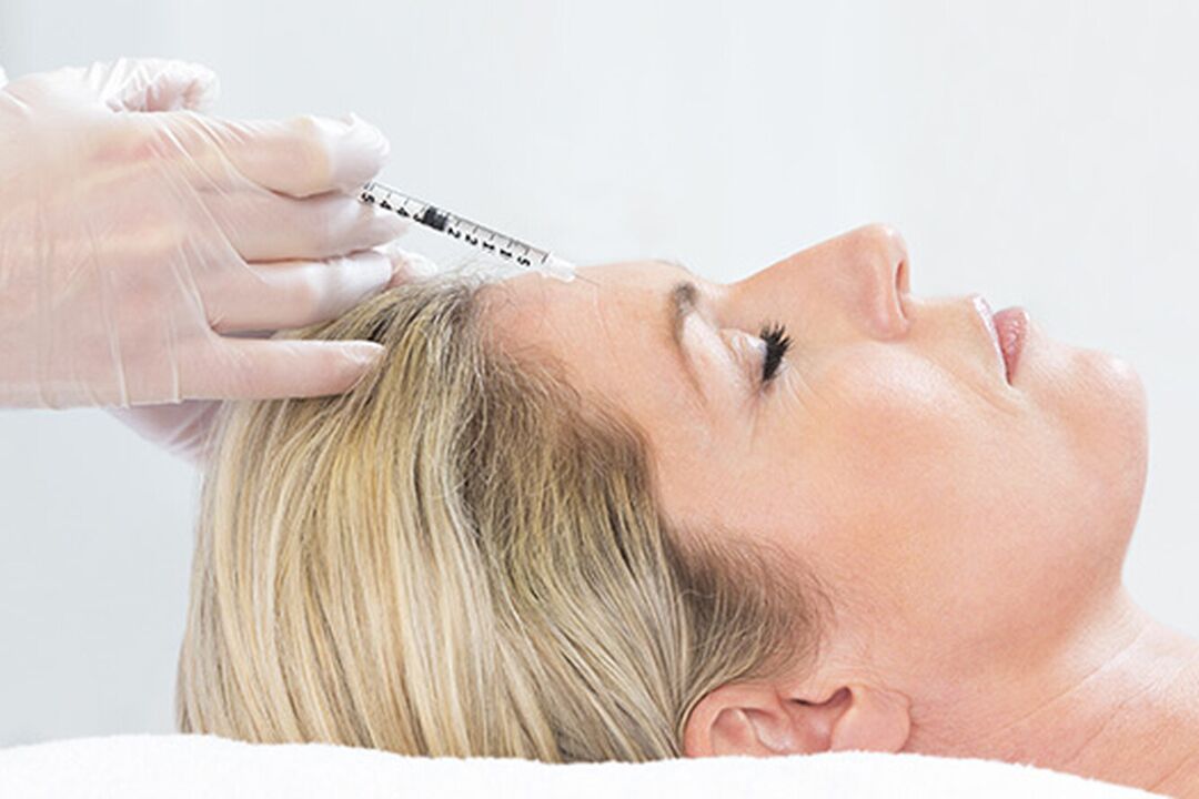 Plasmolifting is an injection method for rejuvenating the skin of the face